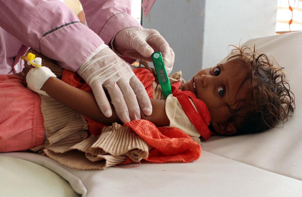 A Yemeni child suspected of being infected with cholera is checked by a doctor at a makeshift hospital operated by Doctors Without Borders (MSF) in the northern district of Abs in Yemen's Hajjah province. — AFP