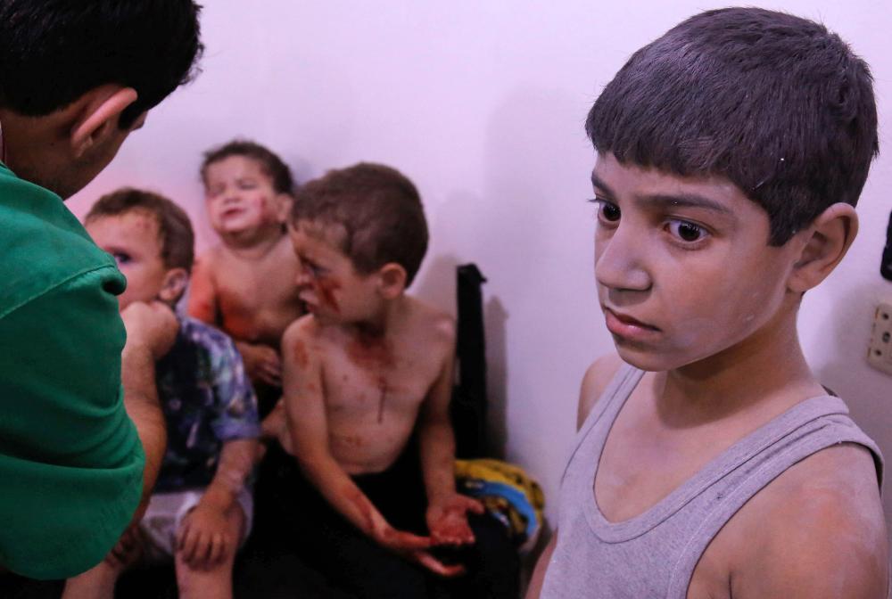 A Syrian child look on as he waits to receive treatment at a make-shift hospital after he was injured in shelling by Assad forces on the rebel-held town of Arbin, east of the capital, late on Monday.  Women and children were among the dead in the 11:30 pm (2030 GMT) strike on Arbin in the Eastern Ghouta rebel enclave where the government declared a ceasefire on July 22, the Syrian Observatory for Human Rights said. — AFP