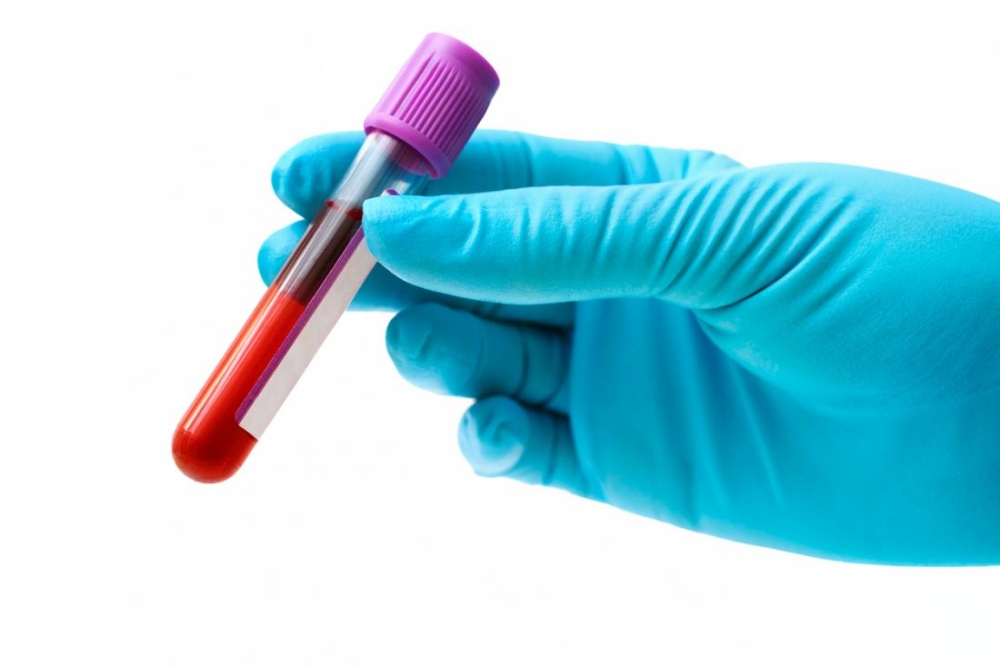 Employees in question have been reportedly altering blood test results by tampering with the samples when they were transported from the draw-room to the laboratory. — Representational photo