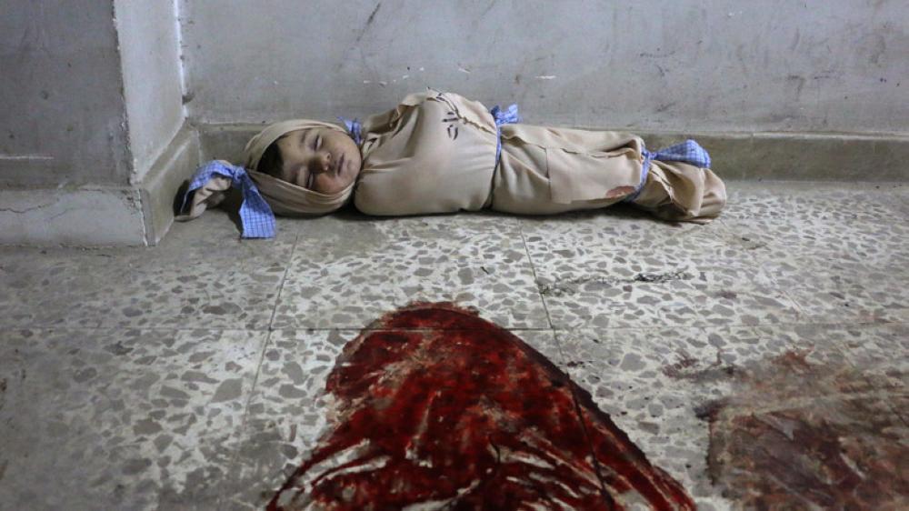 Hala, 9, receives treatment at a makeshift hospital following Syrian government bombardments in Eastern Ghouta. — AFP