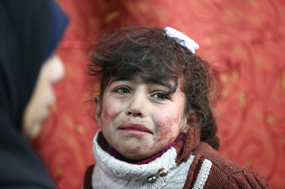 Hala, 9, receives treatment at a makeshift hospital following Syrian government bombardments in Eastern Ghouta. — AFP