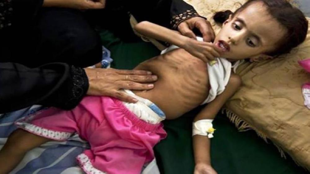 Thousands of families in Yemen are unable to provide bread and milk to their children. — Courtesy photo