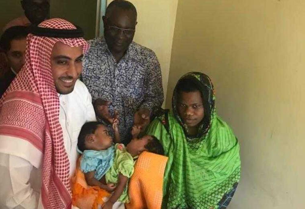 Saudi Embassy to airlift Tanzanian conjoined twins to Saudi Arabia