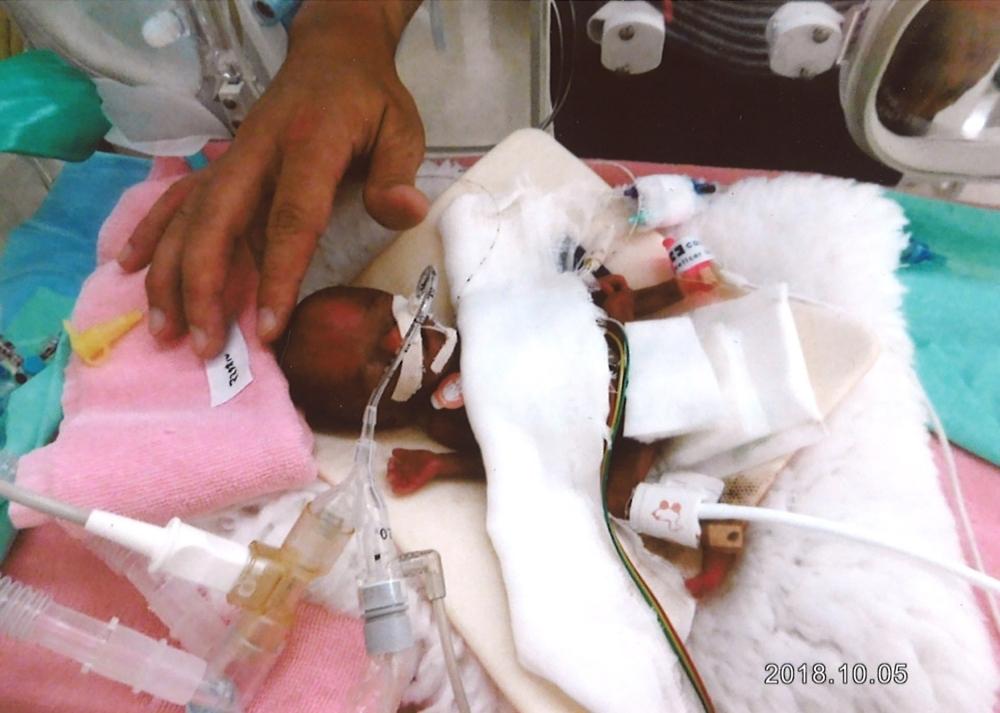 This handout picture taken on Oct. 5, 2018 and released by Nagano Children’s hospital on Friday shows Ryusuke Sekiya being treated at Nagano Children’s hospital in Azumino. — AFP