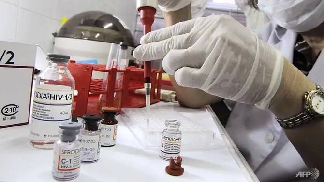 A medical technician conducts a HIV screening test on blood serum samples. — Archives