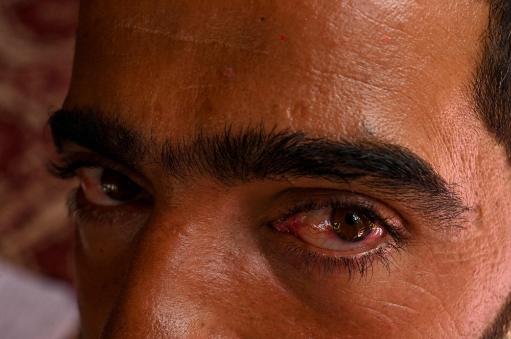 Abid Khan, 26, looks on during an interview at Haripora village in Shopian district, in the Indian state of Jammu and Kashmir in this Sept. 12, 2019 file photo. — AFP