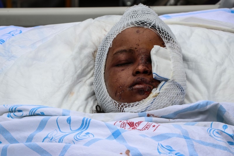 A wounded girl, from the December 28, 2019 car bombing in Mogadishu, is carried on a hospital bed to a Turkish Air Force aircraft for medical evacuation to Turkey at the Adan Adde international airport in Mogadishu on Sunday. -AFP