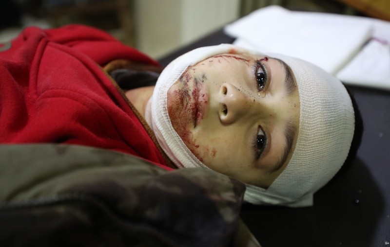 An injured Syrian child cries after being transported to a clinic for treatment following an air strike by pro-regime forces on the northwestern city of Idlib on Saturday. — AFP