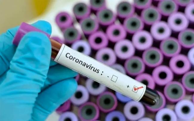 Egypt confirms first coronavirus case in Africa