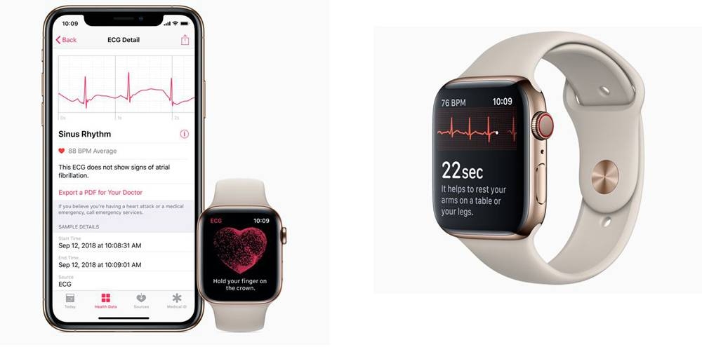 Apple ECG feature on Apple Watch will be available in the Kingdom of Saudi Arabia in the next software update with iOS 13.5 and watchOS 6.2.5. The ECG app and the irregular rhythm notification feature have received approval as Class IIa medical devices by the Saudi Food and Drug Authority. 