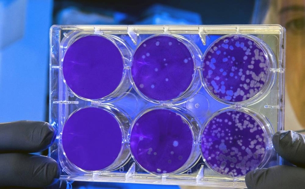 A scientist tests a sample suspected of containing a bacterial toxin. — courtesy CDC
