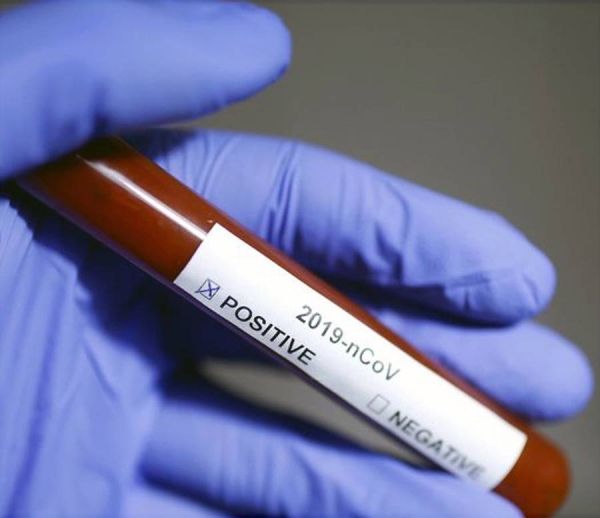Evidence has been accumulating that there might be an association between blood type O and a lower risk of COVID-19 and getting severely ill, and now a new study adds to that research.