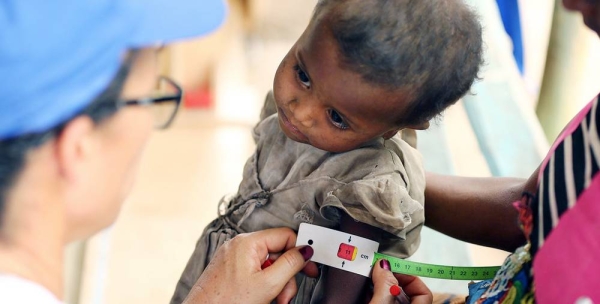 A child undergoes a malnutrition test in Madagascar. — courtesy WFP/Tsiory Andriantsoarana