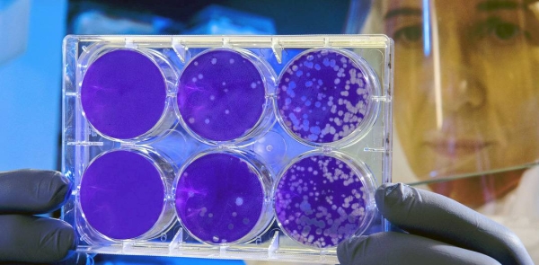 File photo shows a scientist studies virus samples. — courtesy CDC