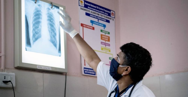 A doctor in Gujarat, India, checks a patient’s chest x-ray for signs of tuberculosis or other lung infections. — courtesy UNICEF/Vinay Panjwani