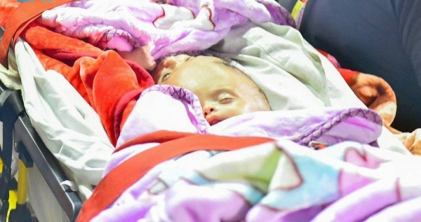 The Yemeni Siamese twins Yousuf and Yassin arrived at King Salman Airbase Wednesday, accompanied by their parents. — SPA