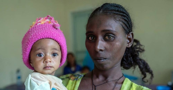 

Yeshialem Gebreegziabher, 27, holds her daughter, Kalkidan Yeman, 6 months old, who is suffering from malnutrition at Aby Adi Health center in the Tigray region of northern Ethiopia. — courtesy UNICEF