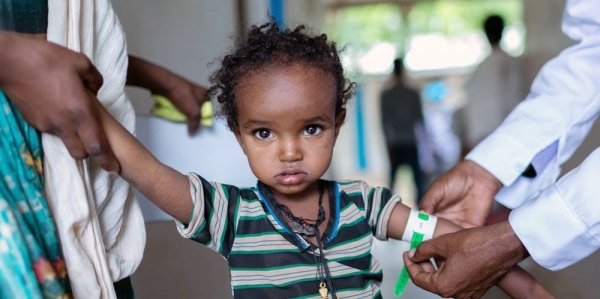 A young girl undergoes a health-check at a health center in the Tigray region of northern Ethiopia. — courtesy UNICEF/Mulugeta Ayene