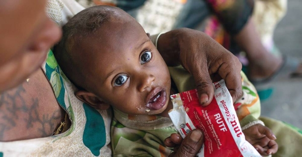 A one-year-old boy is treated for malnutrition at a health center in the Tigray region of northern Ethiopia. — courtesy UNICEF/Mulugeta Ayene