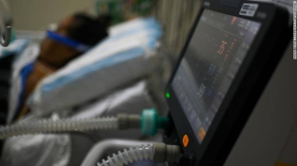 An intubated coronavirus patient is seen next to a pulmonary ventilator at Ronaldo Gazolla Hospital ICU in Acari, Rio de Janeiro, Brazil, on April 30, 2020.