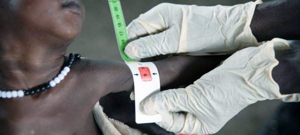 A nutrition worker measures the arm of a severely malnourished baby at a clinic in South Sudan. — courtesy UNICEF/Helene Sandbu Ryeng