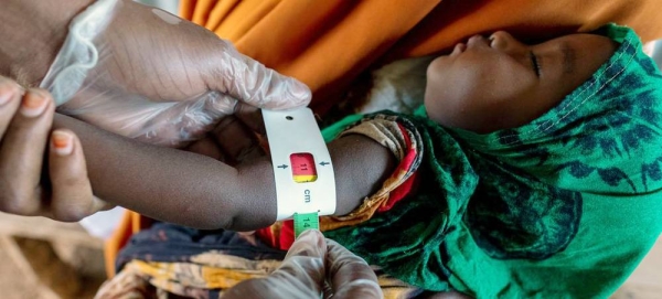 A child of seven months is being examined for malnutrition due to the severe drought in Somalia. — courtesy UNICEF/Sebastian Rich