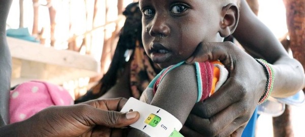 A malnourished child is assessed at a nutrition clinic in Fangak county, South Sudan. — courtesy WFP/Marwa Awad