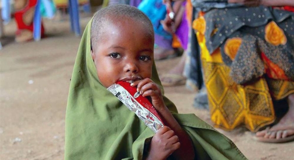 Four-year-old Faylow is one of the 160,000 children treated for severe malnutrition by UNICEF in Somalia in 2017. — courtesy UNICEF Somalia-Makundi