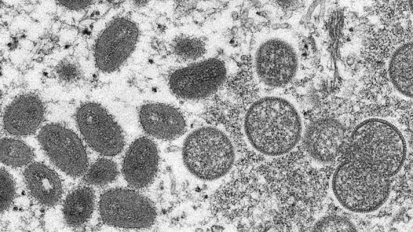 
This 2003 electron microscope image shows mature, oval-shaped monkeypox virions, left, and spherical immature virions, right. — courtesy Cynthia S. Goldsmith, Russell Regner/CDC