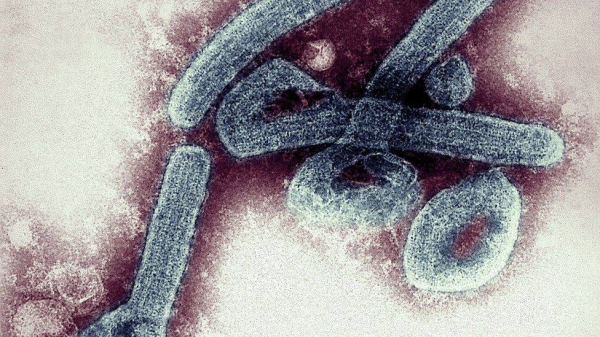 The Marburg virus was first detected in the city of Marburg in Germany in 1967.
