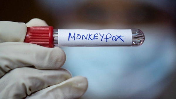 A medical professional holds a test tube labelled monkeypox.