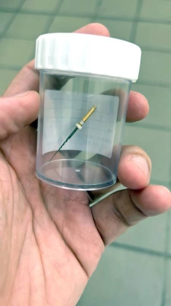 Probe into citizen’s ingestion of tooth extraction tool in Madinah