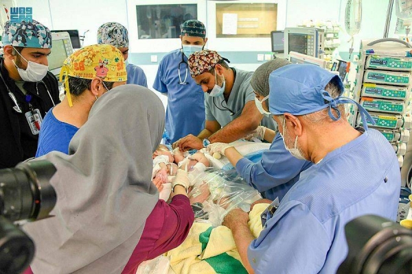 11-hour surgery to separate Iraqi conjoined twins Ali and Omer begins in Riyadh