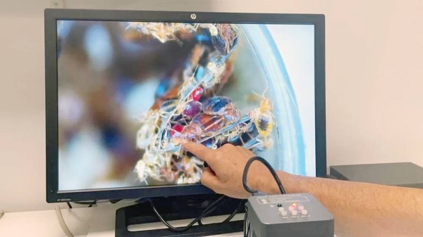 Bed bugs — shown here on a display screen at a Marseille hospital — are spreading across France.