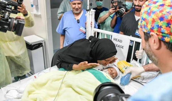 A medical team, headed by Dr. Abdullah Al Rabeeah, and comprising 35 consultants, specialists, and technical, nursing and support staff took part in the surgical separation of the Tanzanian conjoined twins— Hassan and Hussein.