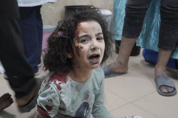 A Palestinian child wounded in Israeli bombardment is brought to a hospital in Deir al Balah, south of the Gaza Strip, Thursday, Nov. 2, 2023