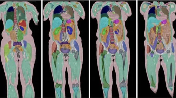 Biggest human imaging study scans 100,000th person