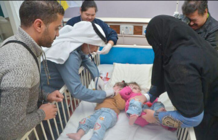 Dr. Abdullah  Al-Rabeeah checking up the Egyptian twins. — SPA