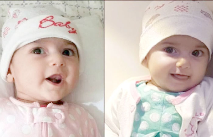 Fatemeh Reshad has structural abnormalities and two holes in her heart.
