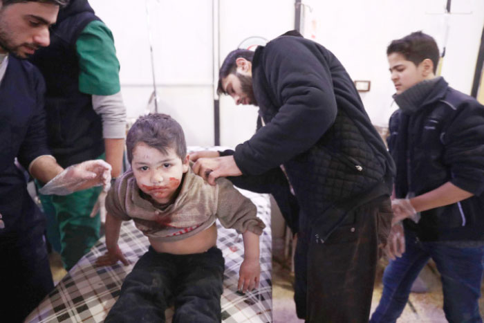 A wounded Syrian boy receives treatment at a make-shift hospital following a reported government airstrike on the rebel-held town of Douma, on the eastern outskirts of the capital Damascus. — AFP