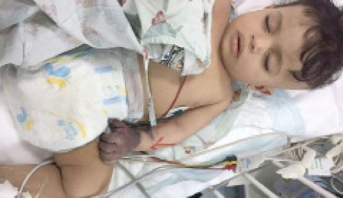 Nine-month-old Jassar Al-Selami at King Fahd Hospital in Al-Baha with his left hand paralyzed following an injection he was given at a hospital in Qunfudah earlier. — Okaz photo